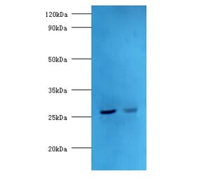 Adiponectin Polyclonal Antibody from Signalway Antibody (42649) - Antibodies.com