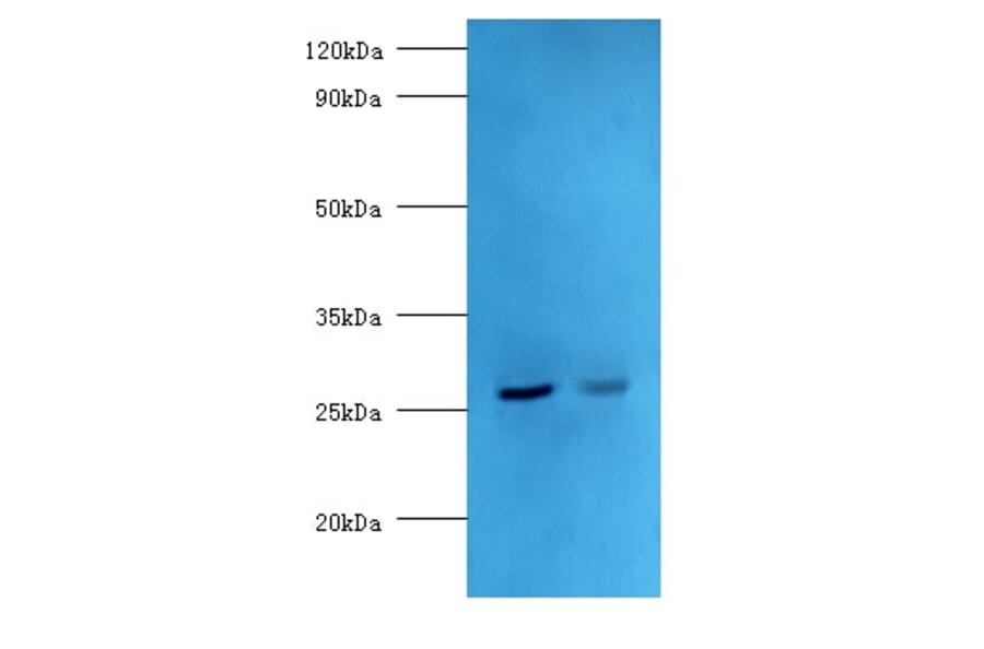 Adiponectin Polyclonal Antibody from Signalway Antibody (42649) - Antibodies.com