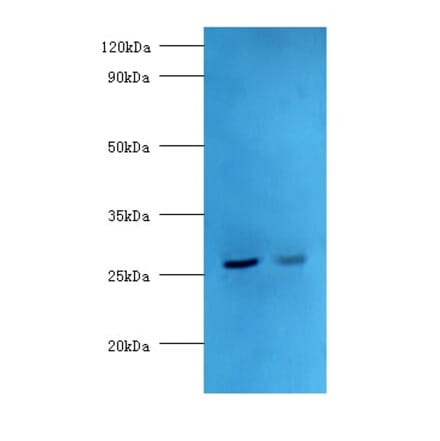 Adiponectin Polyclonal Antibody from Signalway Antibody (42649) - Antibodies.com