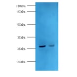 Adiponectin Polyclonal Antibody from Signalway Antibody (42649) - Antibodies.com