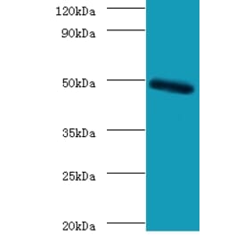 C-type lectin domain family 18 member A Polyclonal Antibody from Signalway Antibody (42125) - Antibodies.com