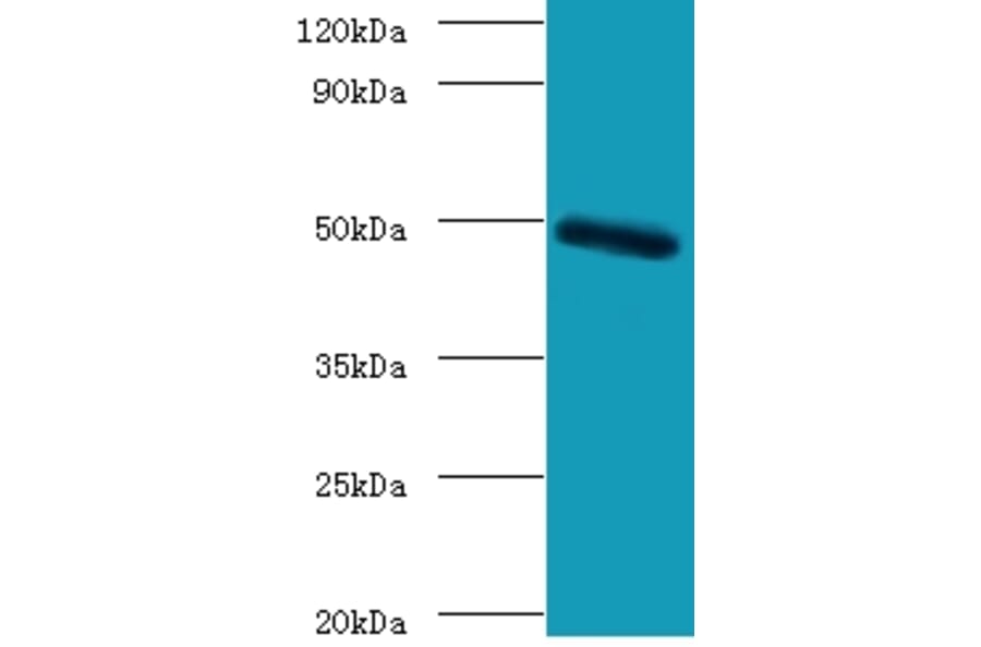 C-type lectin domain family 18 member A Polyclonal Antibody from Signalway Antibody (42125) - Antibodies.com