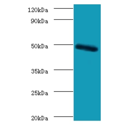 C-type lectin domain family 18 member A Polyclonal Antibody from Signalway Antibody (42125) - Antibodies.com