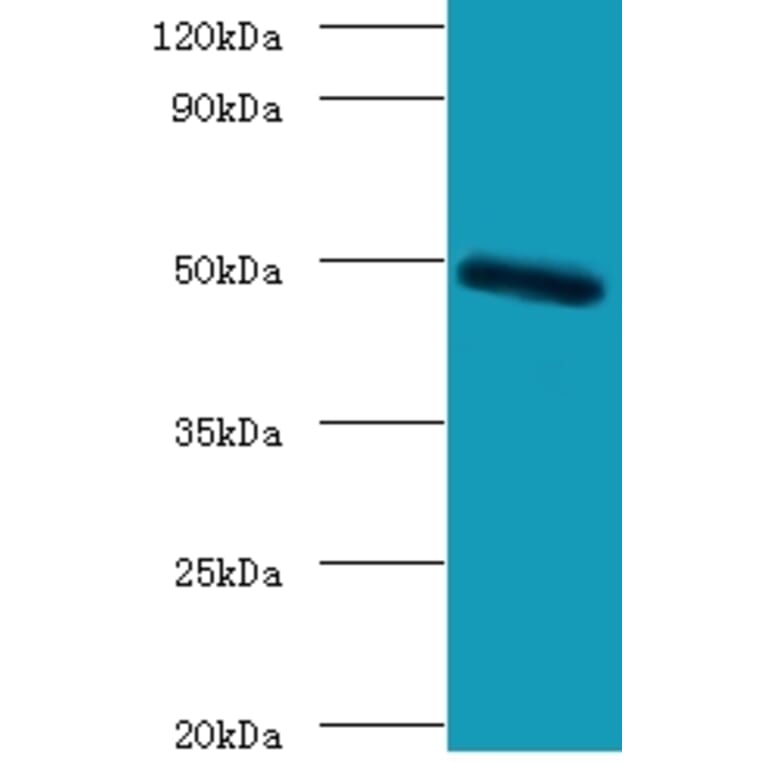 C-type lectin domain family 18 member A Polyclonal Antibody from Signalway Antibody (42125) - Antibodies.com