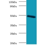 C-type lectin domain family 18 member A Polyclonal Antibody from Signalway Antibody (42125) - Antibodies.com
