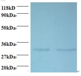 39S ribosomal protein L9, mitochondrial Polyclonal Antibody from Signalway Antibody (42417) - Antibodies.com