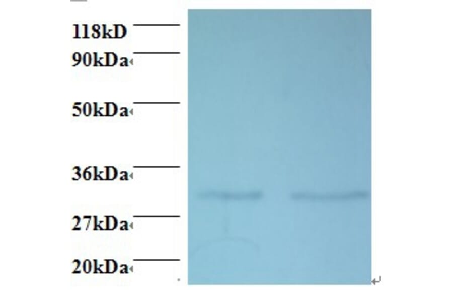 39S ribosomal protein L9, mitochondrial Polyclonal Antibody from Signalway Antibody (42417) - Antibodies.com