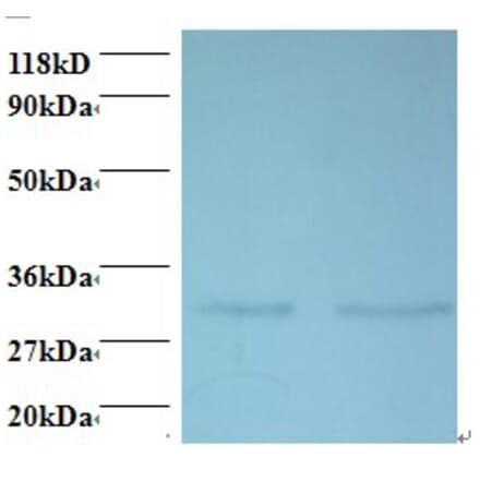 39S ribosomal protein L9, mitochondrial Polyclonal Antibody from Signalway Antibody (42417) - Antibodies.com