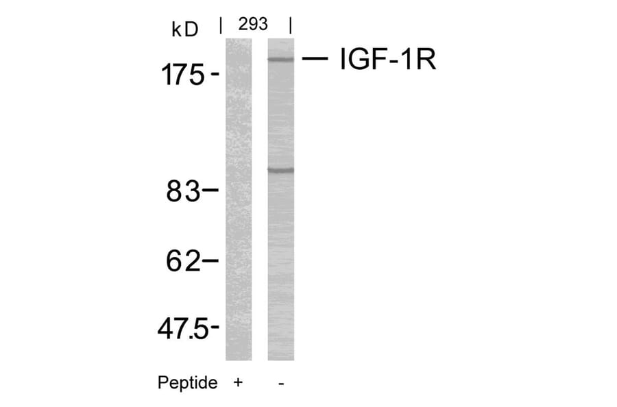 Western blot - IGF-1R (Ab-1165/1166) Antibody from Signalway Antibody (21081) - Antibodies.com