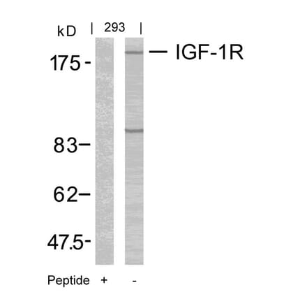 Western blot - IGF-1R (Ab-1165/1166) Antibody from Signalway Antibody (21081) - Antibodies.com