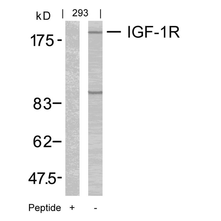 Western blot - IGF-1R (Ab-1165/1166) Antibody from Signalway Antibody (21081) - Antibodies.com