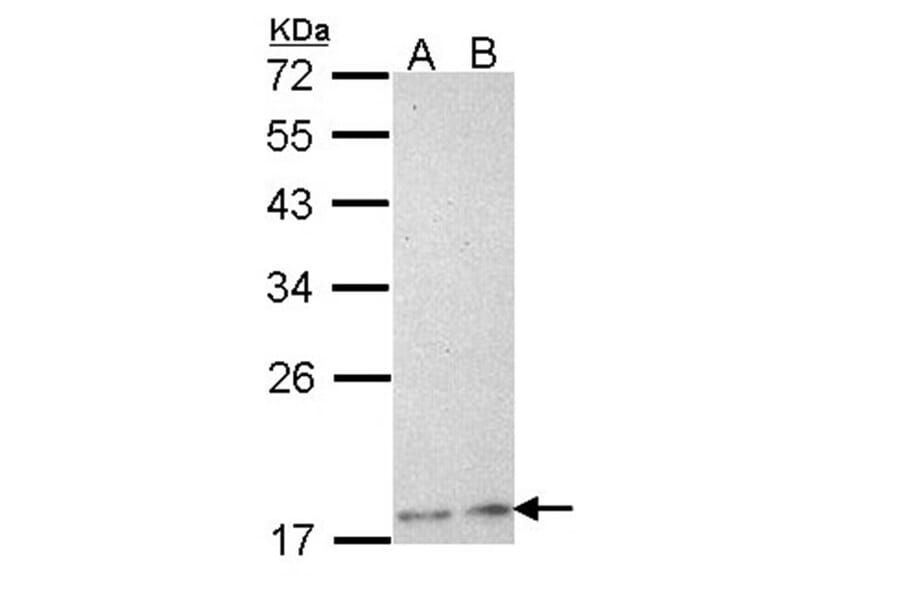 Phospholipase A2 XIIA antibody from Signalway Antibody (22758) - Antibodies.com