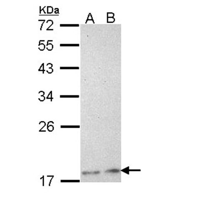 Phospholipase A2 XIIA antibody from Signalway Antibody (22758) - Antibodies.com