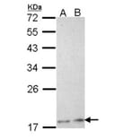 Phospholipase A2 XIIA antibody from Signalway Antibody (22758) - Antibodies.com