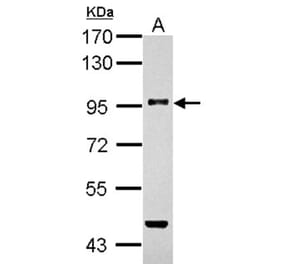 TGF beta Receptor III antibody from Signalway Antibody (22787) - Antibodies.com