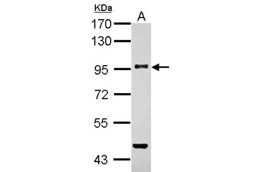 TGF beta Receptor III antibody from Signalway Antibody (22787) - Antibodies.com