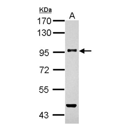 TGF beta Receptor III antibody from Signalway Antibody (22787) - Antibodies.com