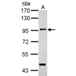 TGF beta Receptor III antibody from Signalway Antibody (22787) - Antibodies.com