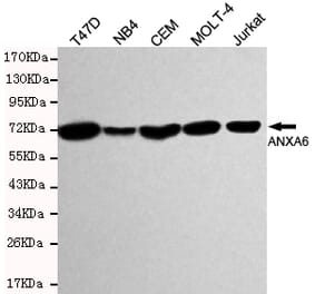 Western blot - Annexin VI Monoclonal Antibody from Signalway Antibody (27198) - Antibodies.com