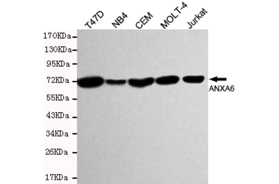 Western blot - Annexin VI Monoclonal Antibody from Signalway Antibody (27198) - Antibodies.com