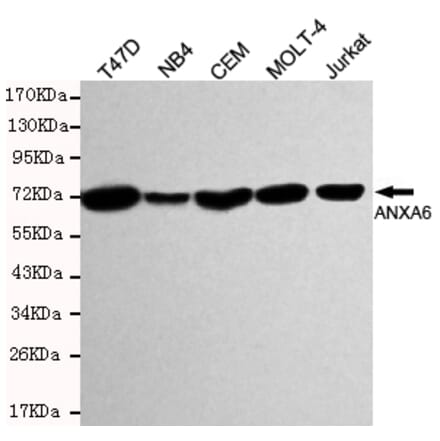 Western blot - Annexin VI Monoclonal Antibody from Signalway Antibody (27198) - Antibodies.com