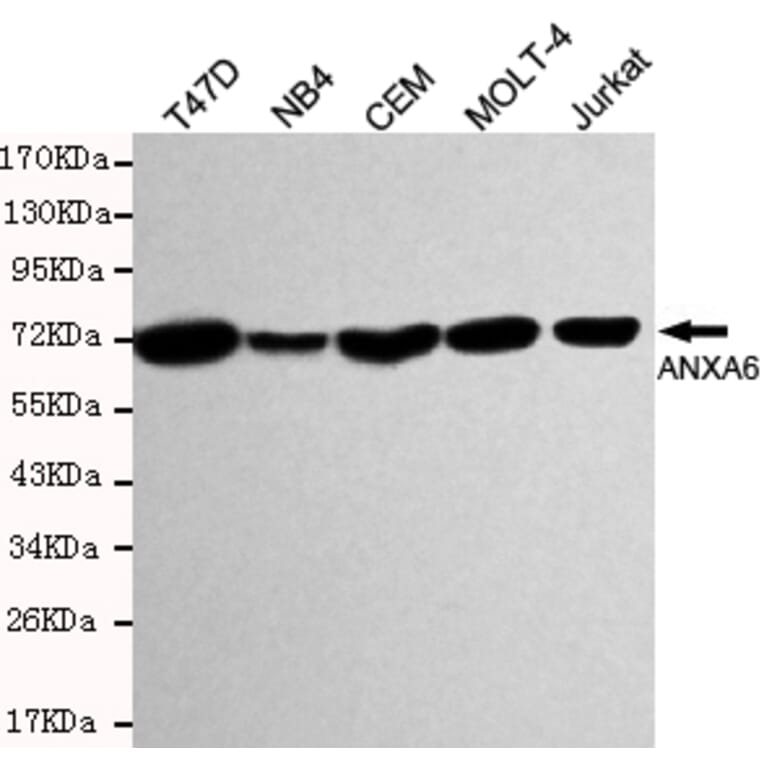 Western blot - Annexin VI Monoclonal Antibody from Signalway Antibody (27198) - Antibodies.com