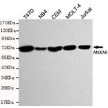 Western blot - Annexin VI Monoclonal Antibody from Signalway Antibody (27198) - Antibodies.com
