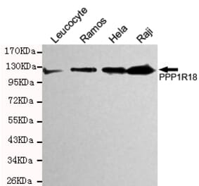 Western blot - Phostensin Monoclonal Antibody from Signalway Antibody (27199) - Antibodies.com