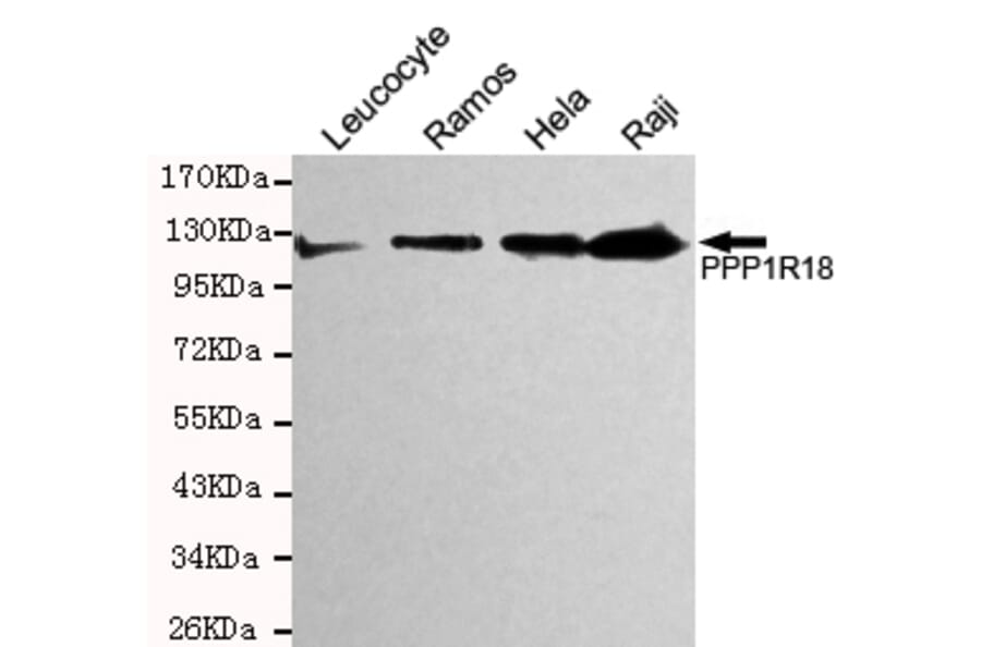 Western blot - Phostensin Monoclonal Antibody from Signalway Antibody (27199) - Antibodies.com
