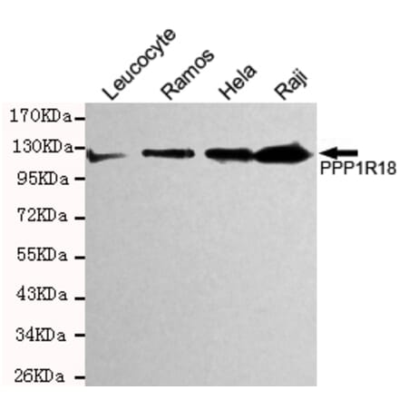 Western blot - Phostensin Monoclonal Antibody from Signalway Antibody (27199) - Antibodies.com