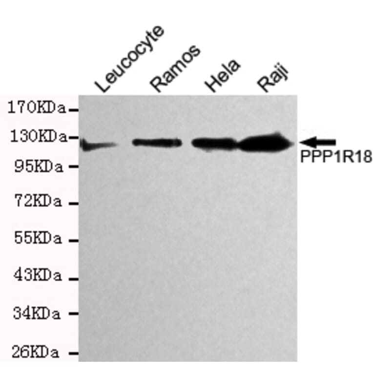Western blot - Phostensin Monoclonal Antibody from Signalway Antibody (27199) - Antibodies.com