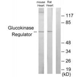 Western blot - Glucokinase Regulator Antibody from Signalway Antibody (33879) - Antibodies.com