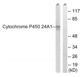 Western blot - Cytochrome P450 24A1 Antibody from Signalway Antibody (34229) - Antibodies.com