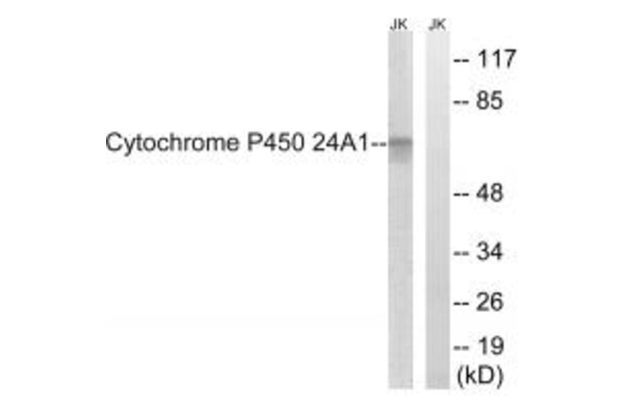 Western blot - Cytochrome P450 24A1 Antibody from Signalway Antibody (34229) - Antibodies.com