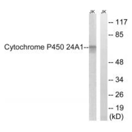 Western blot - Cytochrome P450 24A1 Antibody from Signalway Antibody (34229) - Antibodies.com