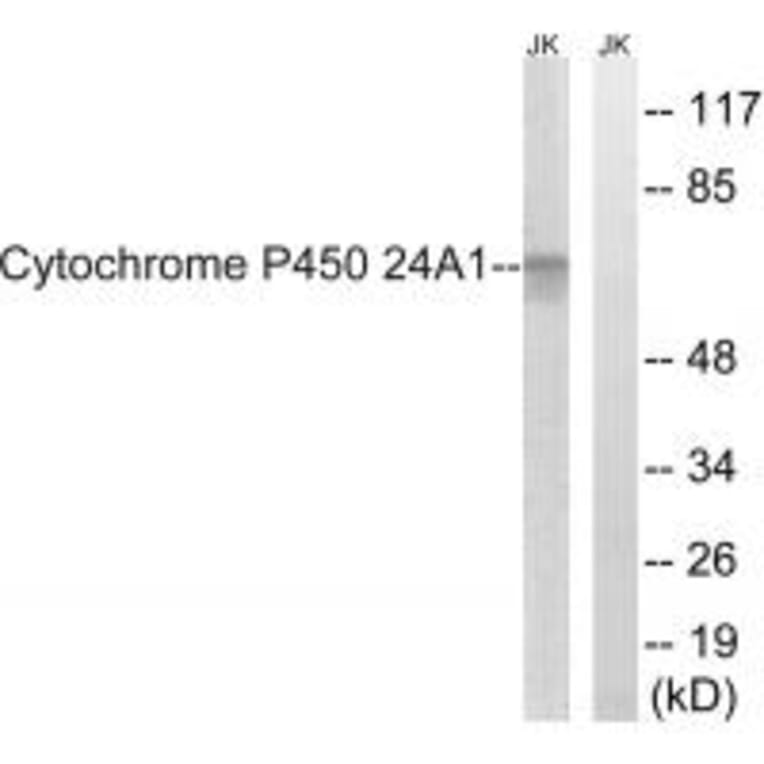 Western blot - Cytochrome P450 24A1 Antibody from Signalway Antibody (34229) - Antibodies.com