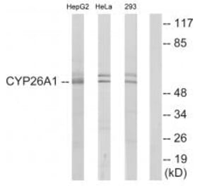 Western blot - Cytochrome P450 26A1 Antibody from Signalway Antibody (34230) - Antibodies.com