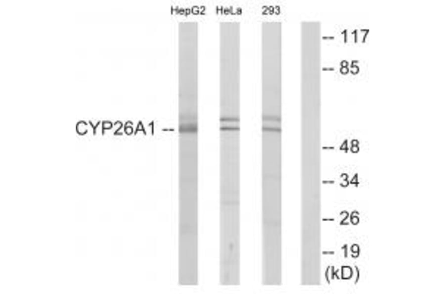 Western blot - Cytochrome P450 26A1 Antibody from Signalway Antibody (34230) - Antibodies.com