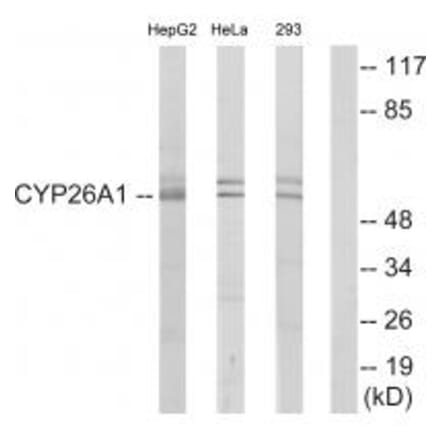 Western blot - Cytochrome P450 26A1 Antibody from Signalway Antibody (34230) - Antibodies.com