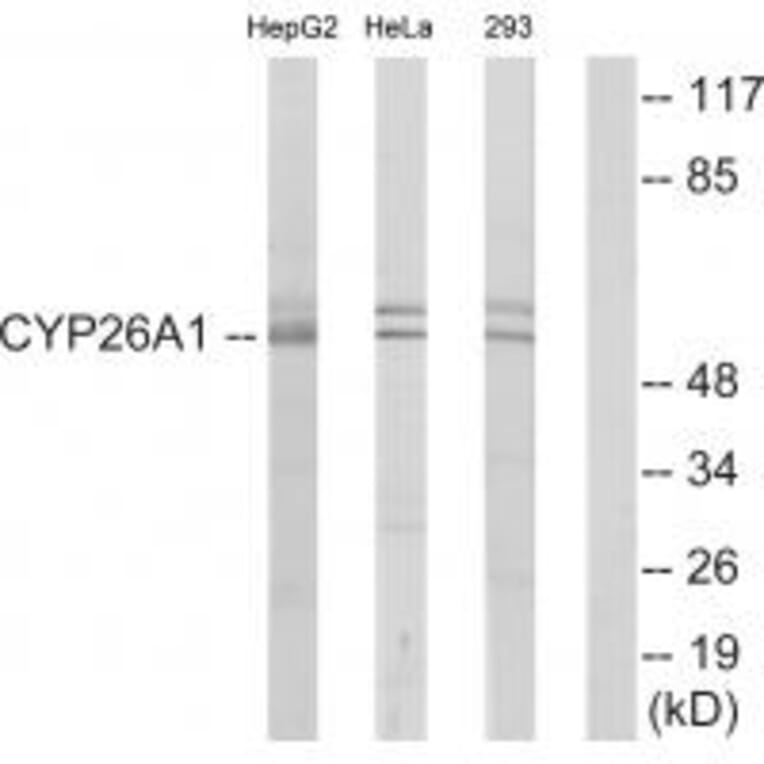 Western blot - Cytochrome P450 26A1 Antibody from Signalway Antibody (34230) - Antibodies.com