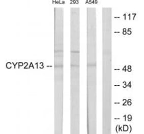 Western blot - Cytochrome P450 2A13 Antibody from Signalway Antibody (34233) - Antibodies.com