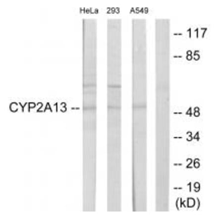 Western blot - Cytochrome P450 2A13 Antibody from Signalway Antibody (34233) - Antibodies.com