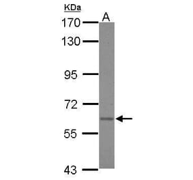 Asparagine synthetase Antibody from Signalway Antibody (35410) - Antibodies.com