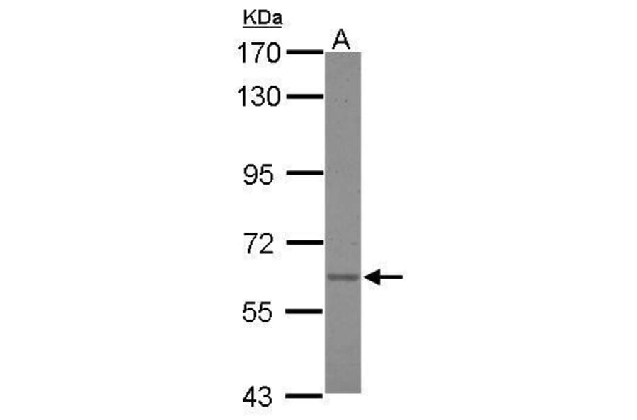 Asparagine synthetase Antibody from Signalway Antibody (35410) - Antibodies.com