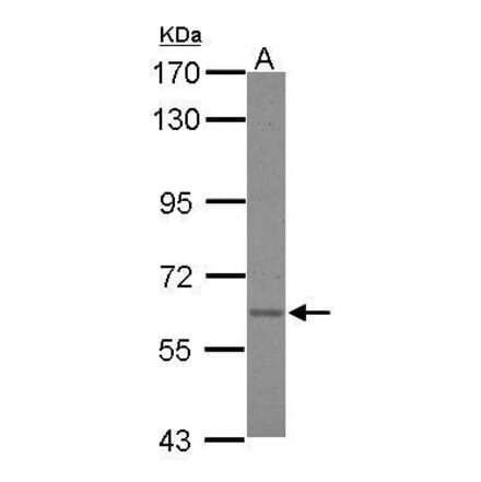 Asparagine synthetase Antibody from Signalway Antibody (35410) - Antibodies.com