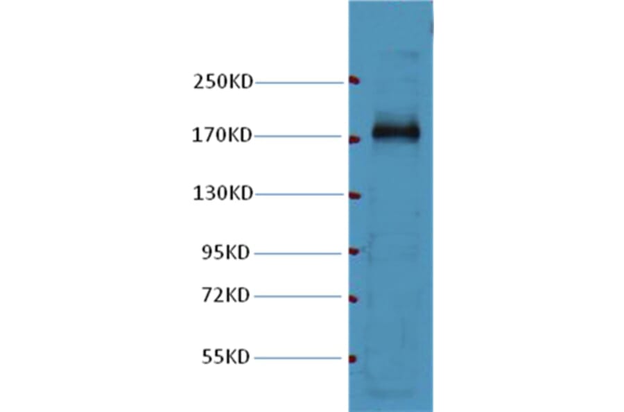 Western blot - EGFR Mouse Monoclonal Antibody from Signalway Antibody (37996) - Antibodies.com
