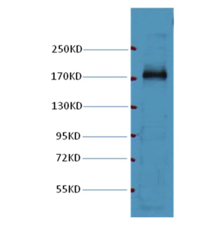 Western blot - EGFR Mouse Monoclonal Antibody from Signalway Antibody (37996) - Antibodies.com