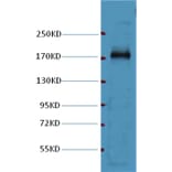 Western blot - EGFR Mouse Monoclonal Antibody from Signalway Antibody (37996) - Antibodies.com