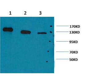 Western blot - PARP Mouse Monoclonal Antibody from Signalway Antibody (38067) - Antibodies.com