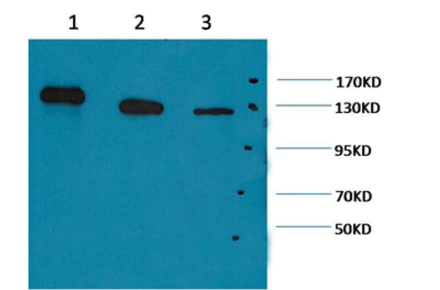 Western blot - PARP Mouse Monoclonal Antibody from Signalway Antibody (38067) - Antibodies.com